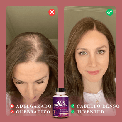 EternalHair®