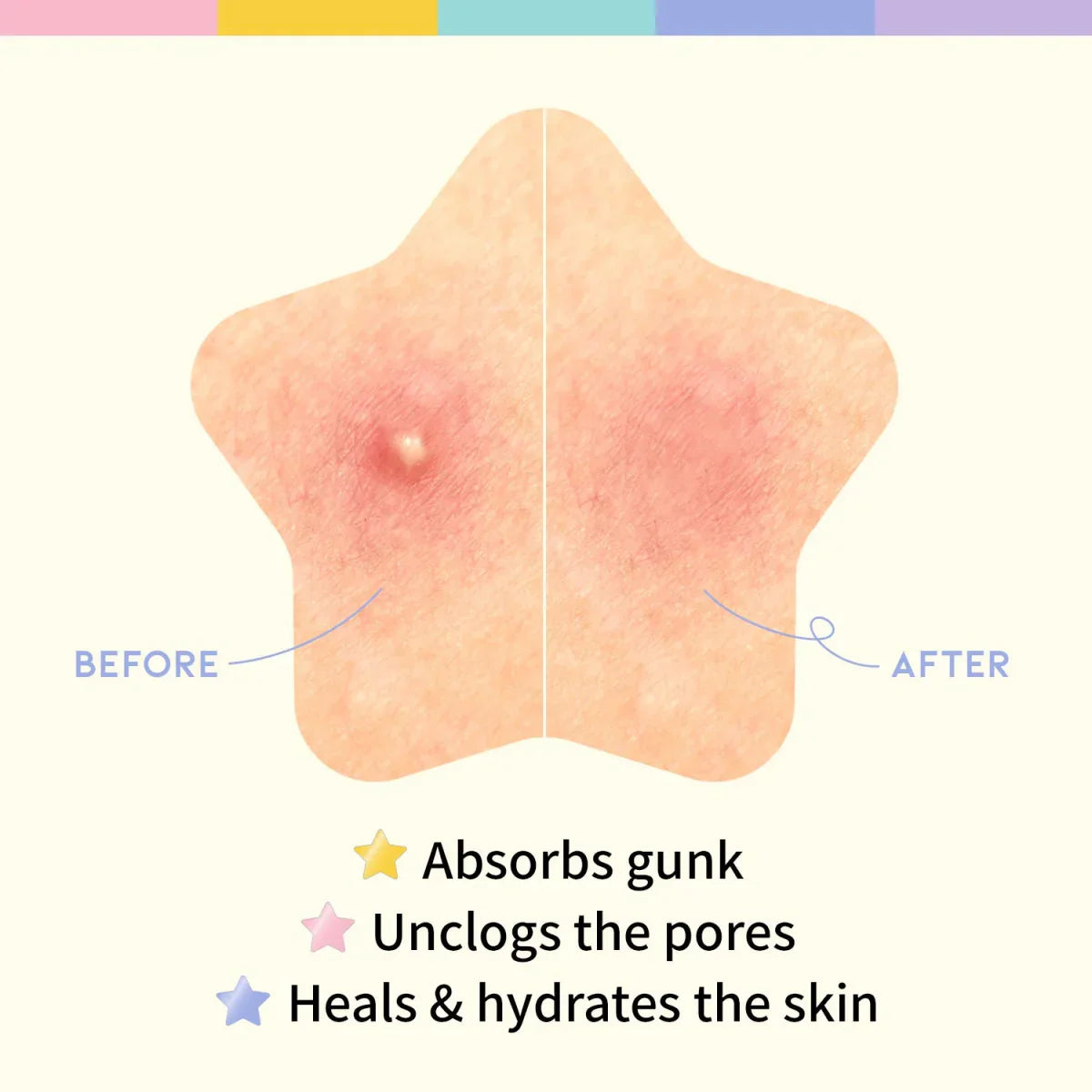 OOTD BEAUTY Star Spot Patch – Parches Estelares para el Tratamiento de Granos y Acné